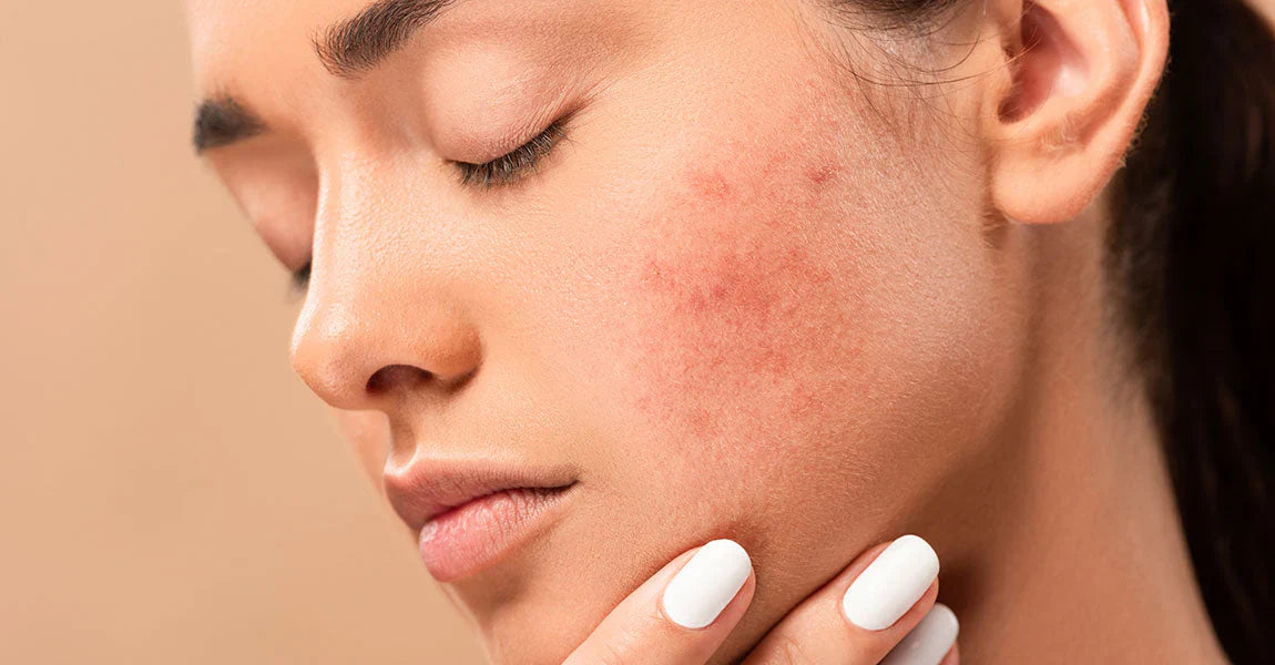 peau abîmée soleil Nutrimea