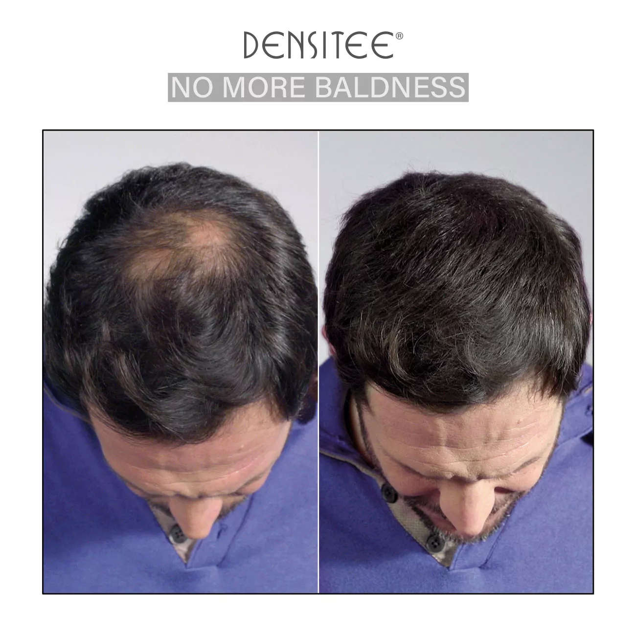 Haarverdichtungspuder zum Kaschieren von kahlen Stellen im Haar - männlich Haarverdichtungspuder zum Kaschieren von kahlen Stellen im Haar - männlich