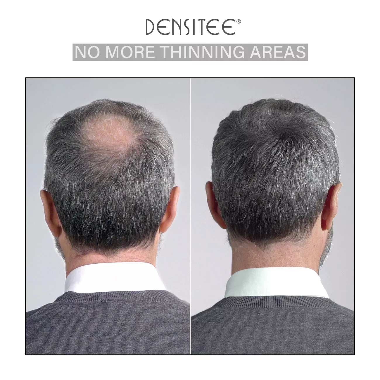 Puder zum Maskieren von Haarausfall Puder zum Maskieren von Haarausfall